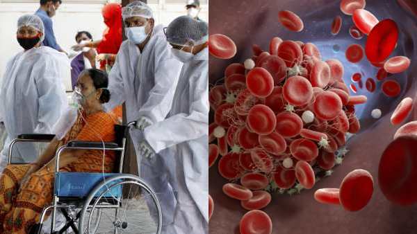 Global Studies Reveal Covid-19 Can Cause Dangerous Blood Clots Global Studies Reveal Covid-19 Can Cause Dangerous Blood Clots