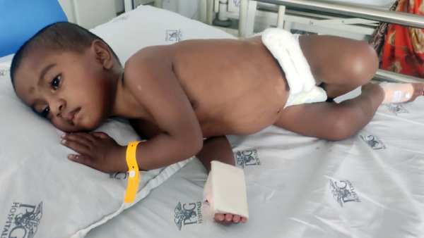 Help Sathyasri to get her treatment done in Madurai Help Sathyasri to get her treatment done in Madurai