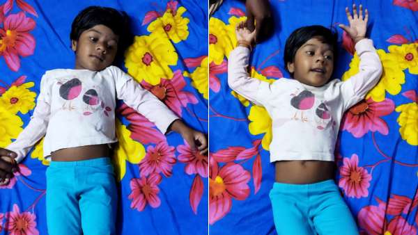 Help 3 year old Jeshika recover from Pulmonary Atresia/VSD, PDA supplying branch PAs Help 3 year old Jeshika recover from Pulmonary Atresia/VSD, PDA supplying branch PAs
