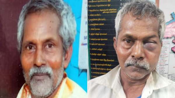 பிரேதப் பரிசோதனை