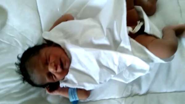 Help 5-month-old Baby Undergo An Emergency Open heart surgery Help 5-month-old Baby Undergo An Emergency Open heart surgery