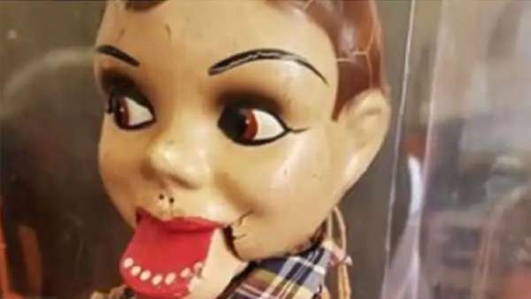 வாயை தானாகவே மூடும் திறக்கும்