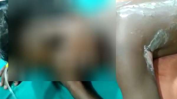 நெருப்பில் தள்ளப்பட்ட மாணவன்