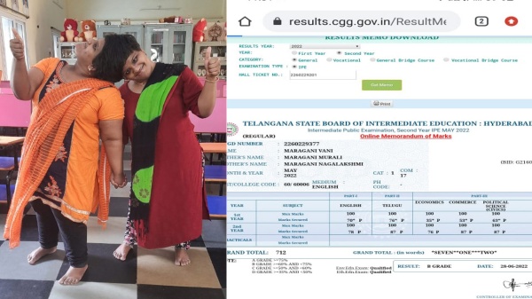 ஒட்டிய தலையுடன் வாழும் “இரட்டை சகோதரிகள்” -தெலுங்கானா இடைநிலைத் தேர்வில் முதல் தரத்தில் வென்று சாதனை 