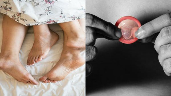 பலருடன் உறவு கொண்டால் குரங்கு அம்மை பரவுமா? ஆணுறை பலனளிக்காதா? ஆய்வாளர்களின் விளக்கம் என்ன? 