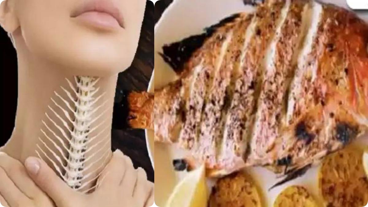 "மீனு முள்ளு".. உங்க தொண்டையில சிக்கிக்கிட்டா பதறாதீங்க. உடனே இதை