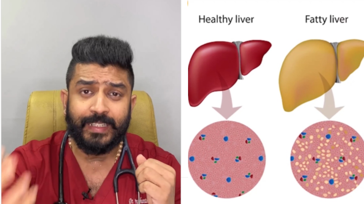 நீங்க மது குடிக்காட்டியும் "அந்த" நோய் இருந்தா "இந்த" நோய் வரும்