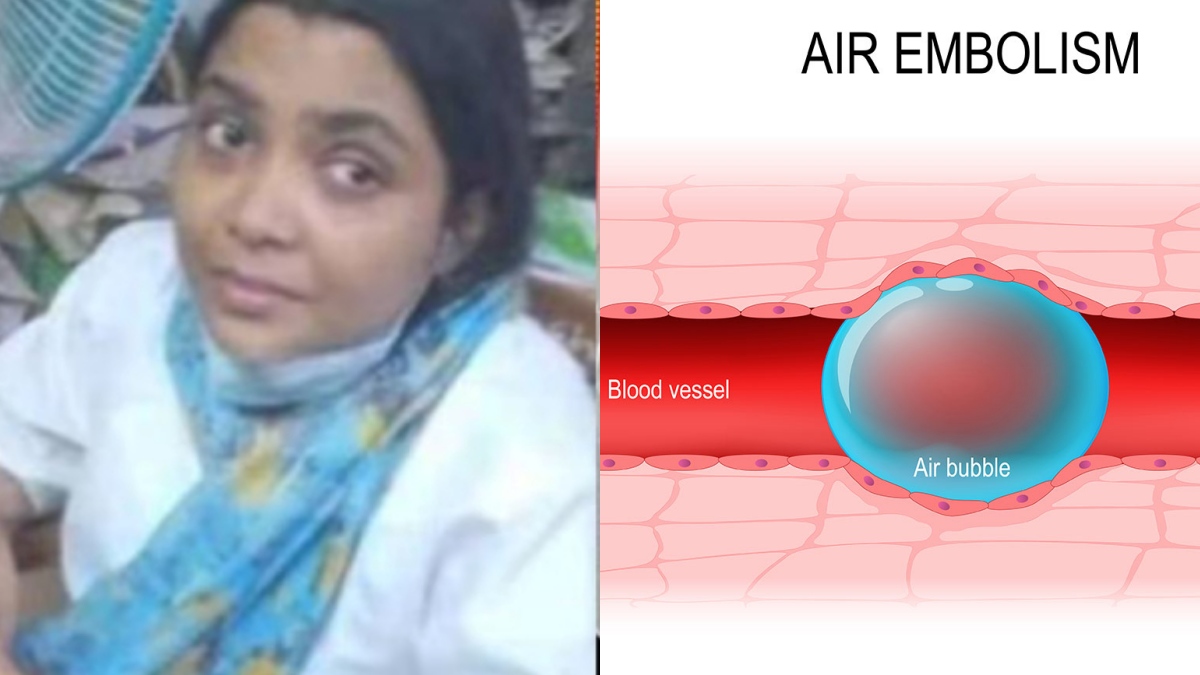 Air embolism நர்ஸ் வேடத்தில் காதலனின் மனைவியை கொல்ல வந்த பெண்! நரம்பில் காற்றை ஏற்றினால் என்ன ஆகும்? 