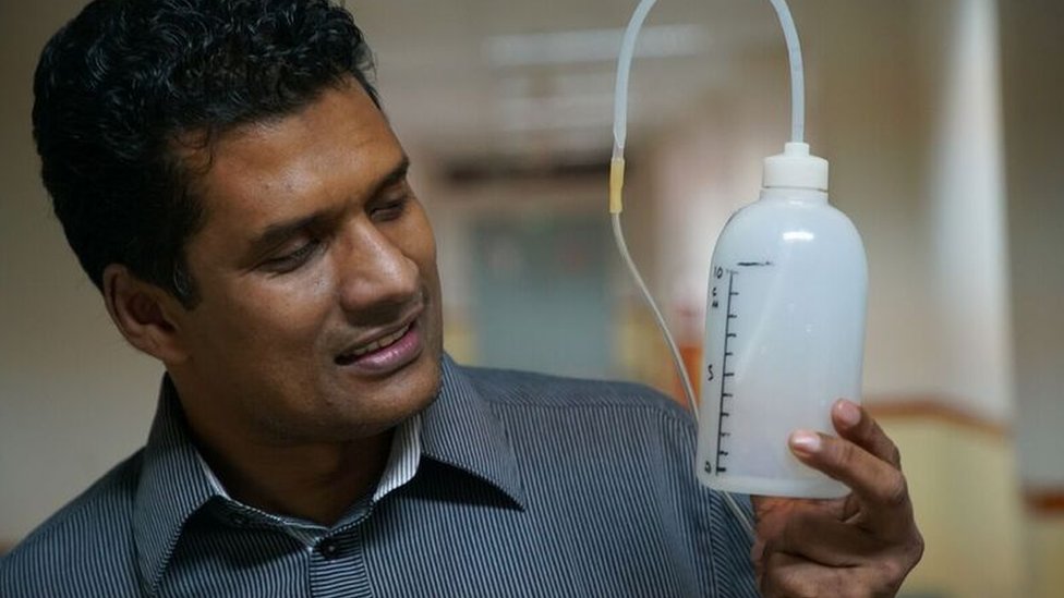 Dr Chisti holding a device made from plastic bottle and tubing Dr Chisti holding a device made from plastic bottle and tubing