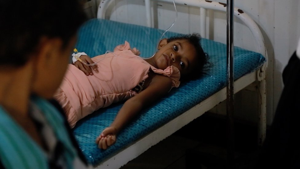 உணவு குறைபாட்டால் யெமெனில் பாதிக்கப்படும் குழந்தைகள்