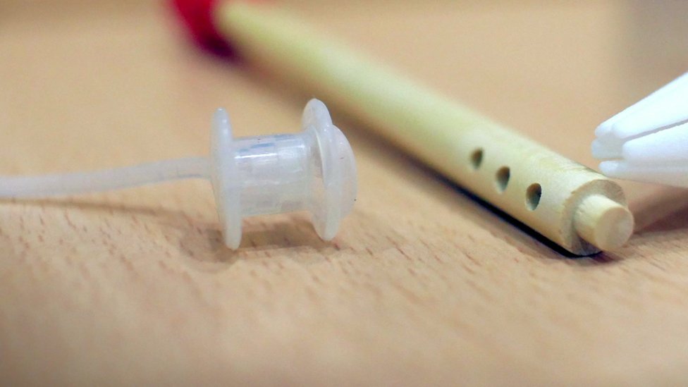 நோயாளியின் தொண்டைக்குள் செருக பயன்படும் சாதனத்துடன் கூடிய குரல்வடம்