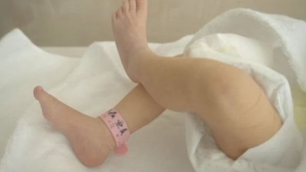 4 கை - 4 கால் குழந்தைகள் பிறப்பது எப்படி?