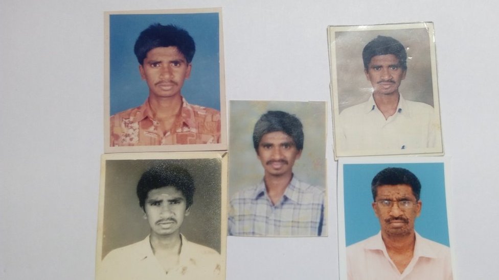 மரபணு குறைபாட்டால் மாறிய முகம்