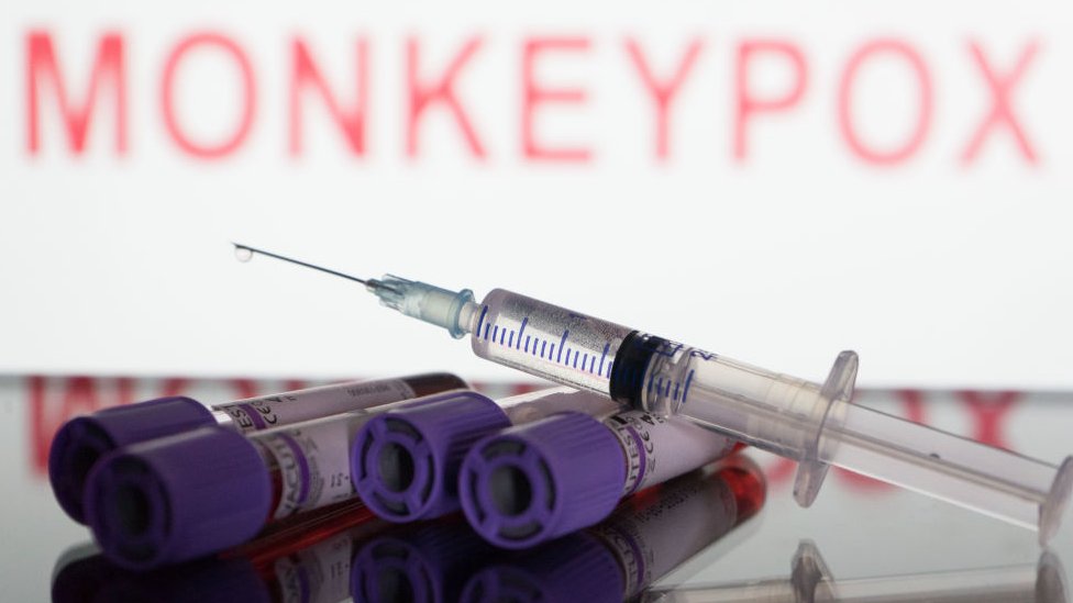 குரங்கம்மை