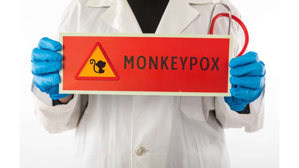 குரங்கம்மை