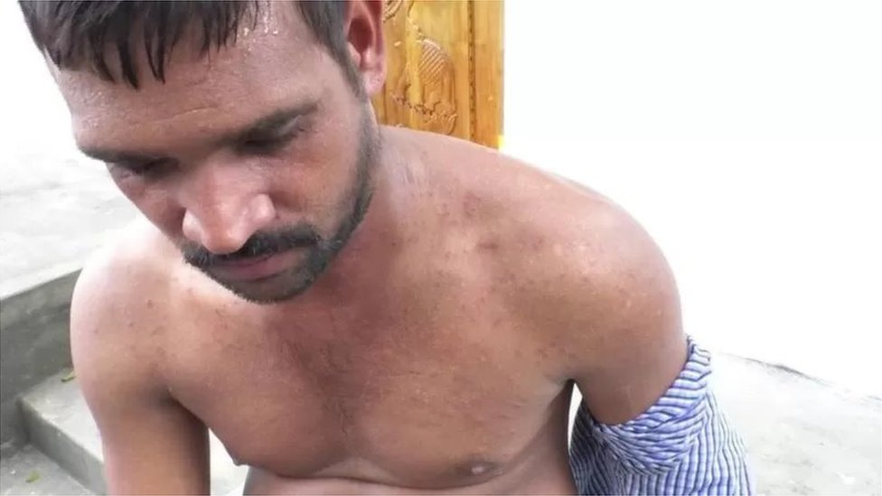 கிராமத்தை தாக்கும் சிவப்பு எறும்பு படை