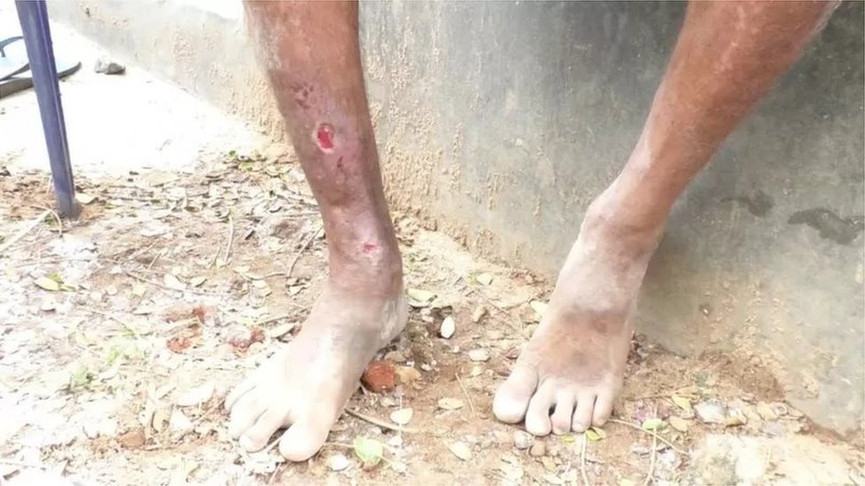 கிராமத்தை தாக்கும் சிவப்பு எறும்பு படை